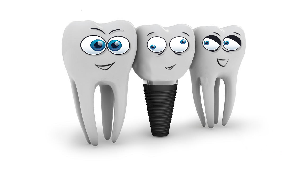 門(mén)牙種植牙多少錢(qián)一顆 門(mén)牙種植牙多少錢(qián)一顆