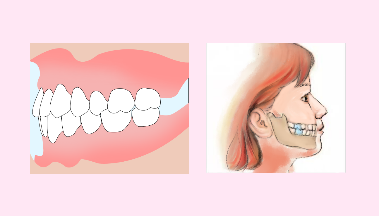 牙齒不整齊 牙齒不整齊