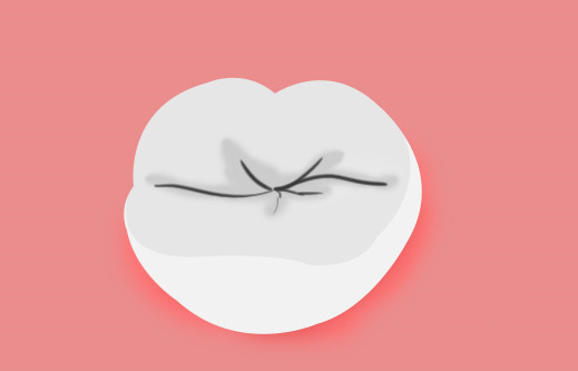 梅州哪里的牙科價(jià)格合適又好 梅州哪里的牙科價(jià)格合適又好