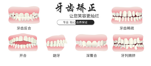 牙齒矯正類(lèi)型